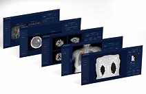 제이엘케이인스펙션, 뇌·폐 분석 솔루션 등 CE 의료기기 인증 5건 획득