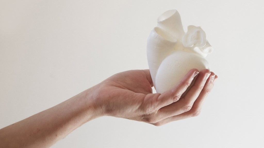 심장이식을 위한 개인맞춤형 인공심장, 3D 프린터로 만든다